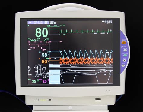 machine used to monitor heart beat